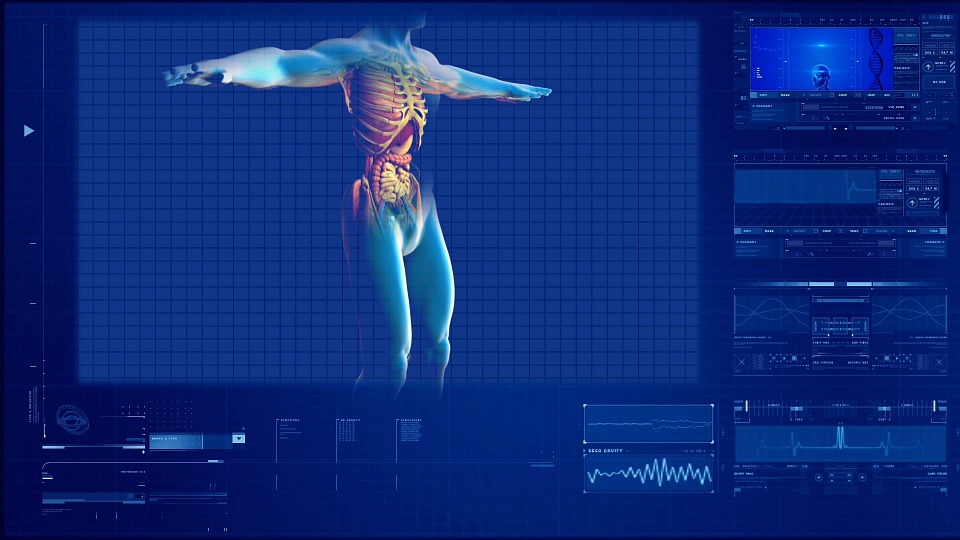 history of x-ray