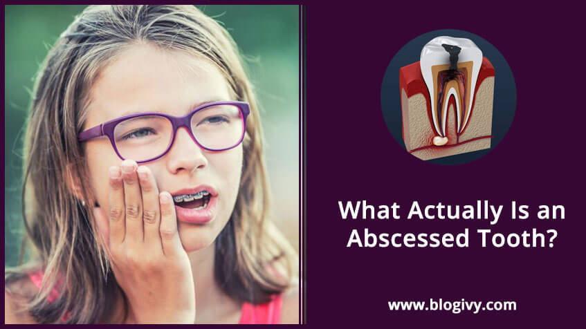 What Actually Is an Abscessed Tooth?